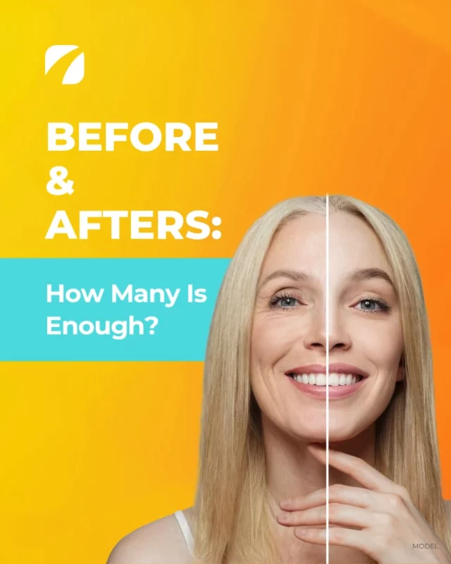 📸 How many before-and-after photos should your practice really be sharing?

Spoiler: Quality + quantity = trust. The more (strong) results you show, the better your chances of converting visitors into patients.⁠

Get the full scoop 👉 link in bio!

#PlasticSurgeryMarketing #MedSpaMarketing #BeforeAndAfterPhotos #MedicalMarketing #AestheticMarketing #DigitalMarketing