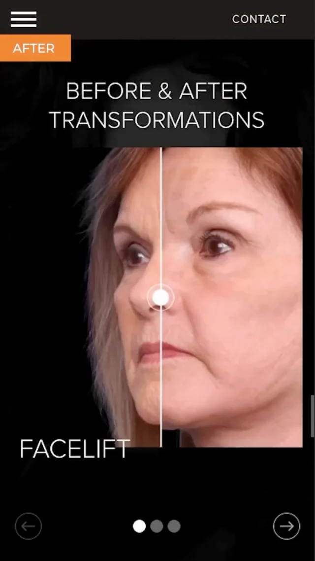 Fresh look. Same exceptional care. ✨

Our redesign for Hobgood Facial Plastic Surgery brings modern design, new photography, and thoughtful storytelling together to reflect the practice’s precision and personality.

A reminder that your website isn’t just a portfolio, it’s your first impression.

Thinking it’s time for a refresh? Tap the link in bio to connect with us.

#EtnaInteractive #WebsiteRedesign #MedicalMarketing #AestheticPractice #PlasticSurgeryWebDesign #DigitalStrategy #PracticeBranding #WebDesignInspiration #FacialPlasticSurgery #ModernWebDesign