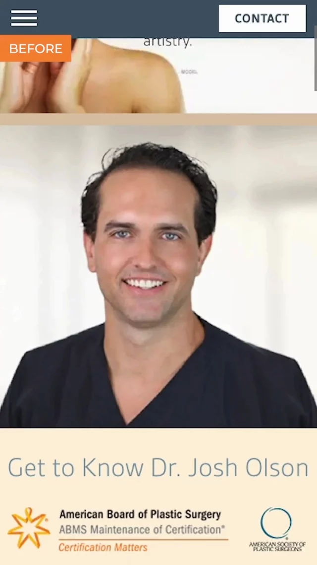 Out with the old, in with the bold. 💫

Our redesign for Advanced Plastic Surgery Institute gives Dr. Olson’s practice a fresh, modern look complete with stunning spotlight photography and a streamlined design that mirrors the elegance and precision patients expect.

Even great sites deserve a glow-up once in a while.

Thinking it’s time for yours? Tap the link in bio to connect with us.

#EtnaInteractive #WebsiteRedesign #MedicalMarketing #PlasticSurgeryWebsite #DigitalMakeover #PracticeBranding #AestheticPractice #FacialPlasticSurgery #ModernWebDesign #HealthcareMarketing